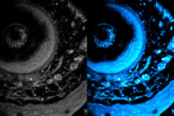Noninvasive Scanning Method Reaches Deeper into Biological Tissues