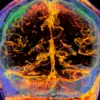 ‘Slime’ keeps the brain safe ― and could guard against ageing