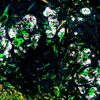 Cell Therapy Cures Type 1 Diabetes in Mice